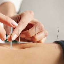 soigner et guérir avec l acupuncture
