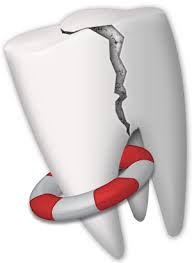 Keadaan yang Tergolong Dental Emergency- Global Estetik Dental Care