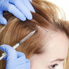 women hair transplant turkish experts