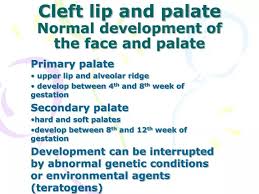 cleft lip and palate normal development