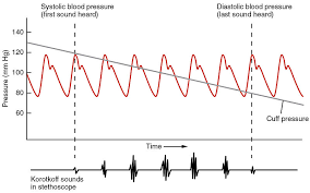 File 2111 Blood Pressure Graph Jpg Wikipedia