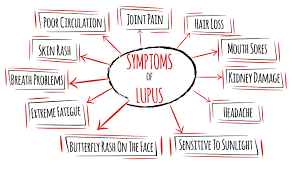 signs and symptoms of lupus elitecare