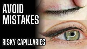 permanent eyeliner on capillary eyelids