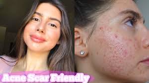acne scar friendly makeup tutorial
