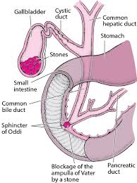 Human liver, gallbladder, pancreas anatomy vector. Gallstones Liver And Gallbladder Disorders Msd Manual Consumer Version