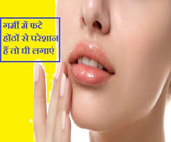 chapped lips care गर म म फट