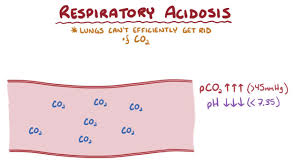 Overview Of The Respiratory System Respiratory System