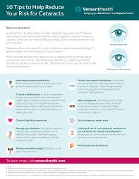 your risk for cataracts versant health