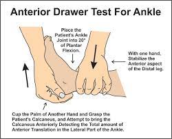 anterior drawer test ankle latest 2023