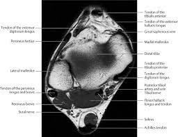 Mri has primarily been used to assess either the. Ankle And Foot Radiology Key