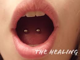 healing process of a tongue piercing