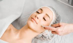 microdermabrasion treatment skin rx