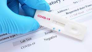 covid 19 les tests antigéniques