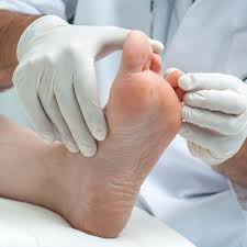 athlete s foot vs fungal toenails