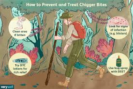 chigger bites treatment and prevention