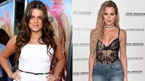 Khloe kardashian before and after plastic surgery. Khloe Kardashian Shares Before And After Photos Of Her 40 Pound Weight Loss Entertainment Tonight