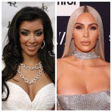 kim kardashian s plastic surgery