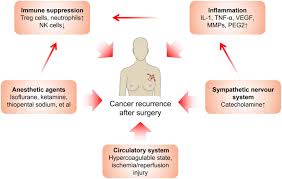 surgical stress and cancer progression