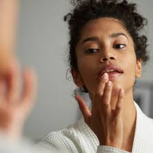 pimples on lips dermatologist shares