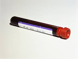 I never asked how bad the bleeding was, and while i sill can since he's now in remission, i'll probably forget to ask. Experimental Blood Test Detects Cancer Up To Four Years Before Symptoms Appear Scientific American