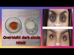 how to remove dark circles overnight