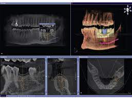 cone beam cbct technology parker