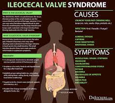the benefits of ileocecal valve mage
