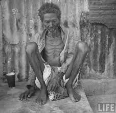 An old man during Bengal famine | Sardar Vallabhbhai Patel