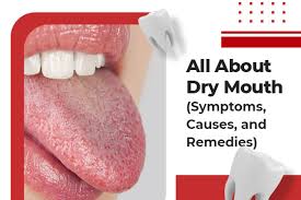 all you need to know about dry mouth