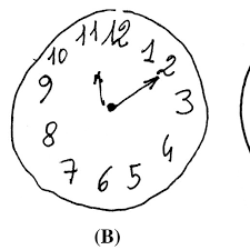 •note the 3 point scoring system. Three Examples Of Clock Drawing Test Cdt Using Rouleau Et Al S Download Scientific Diagram