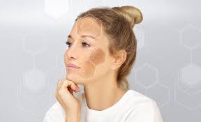 skin discoloration common causes and