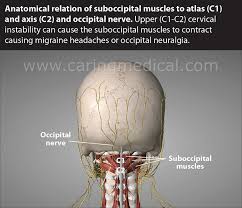 In the center of this region is the. Occipital Neuralgia And Suboccipital Headache C2 Neuralgia Treatments Without Nerve Block Or Surgery Caring Medical Florida