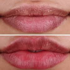 chapped lips my 5 easy hacks