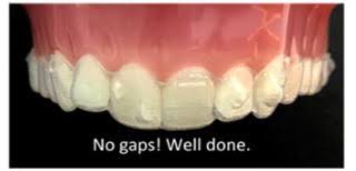 If you don't take the right steps, your treatment could be delayed due to improper tooth tracking. Invisalign Instructions Office Of Dr John Digiovanni Newport Beach California