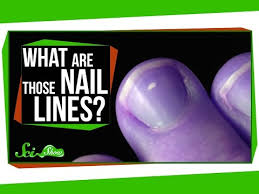white marks on your nails mean