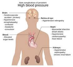 Truck Drivers And High Blood Pressure Information For Truckers
