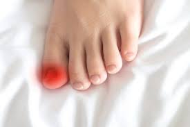 signs your ingrown toenail is infected