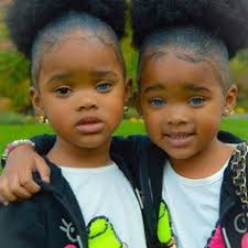 Eye color is controlled by the l.evels of melanin present in the iris and in rare cases this can vary between individual eyes, resulting in a person having two different colored eyes. 200 Best 2 Colored Eyes Heterochromia Ideas Heterochromia Eyes 2 Colored Eyes
