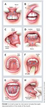 common questions about mouth cancer