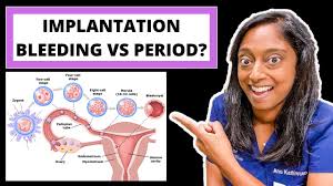 implantation bleeding vs period how to