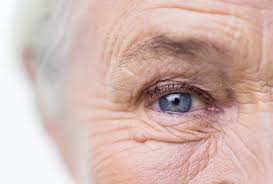 what is dry eye causes symptoms