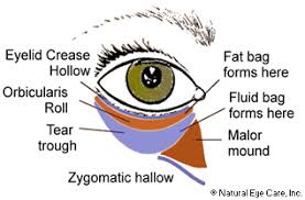 bags under eyes symptoms causes