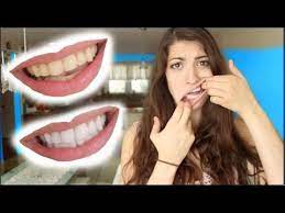 You can try mixing common salt with baking soda and use it to rub gently onto your teeth. How To Whiten Teeth In 2 Minutes Guaranteed Whiten Teeth Youtube