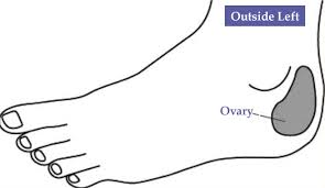 Acupressure For Pcos How It Works Patient Experiences