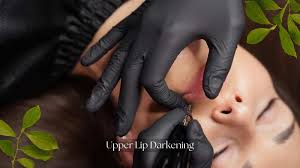 causes of upper lip darkening and