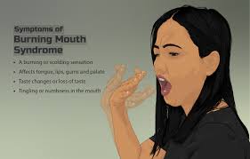 symptoms of burning mouth syndrome