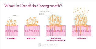 candida overgrowth 10 signs the best