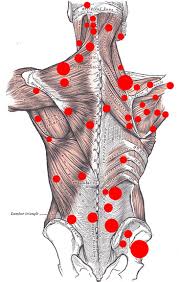 myofascial trigger point therapy back