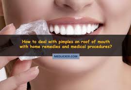 Houselogic has pragmatic advice for homeowners. Pimples On Roof Of Mouth Causes Symptoms And Treatment Options