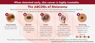 the serious side of skin cancer